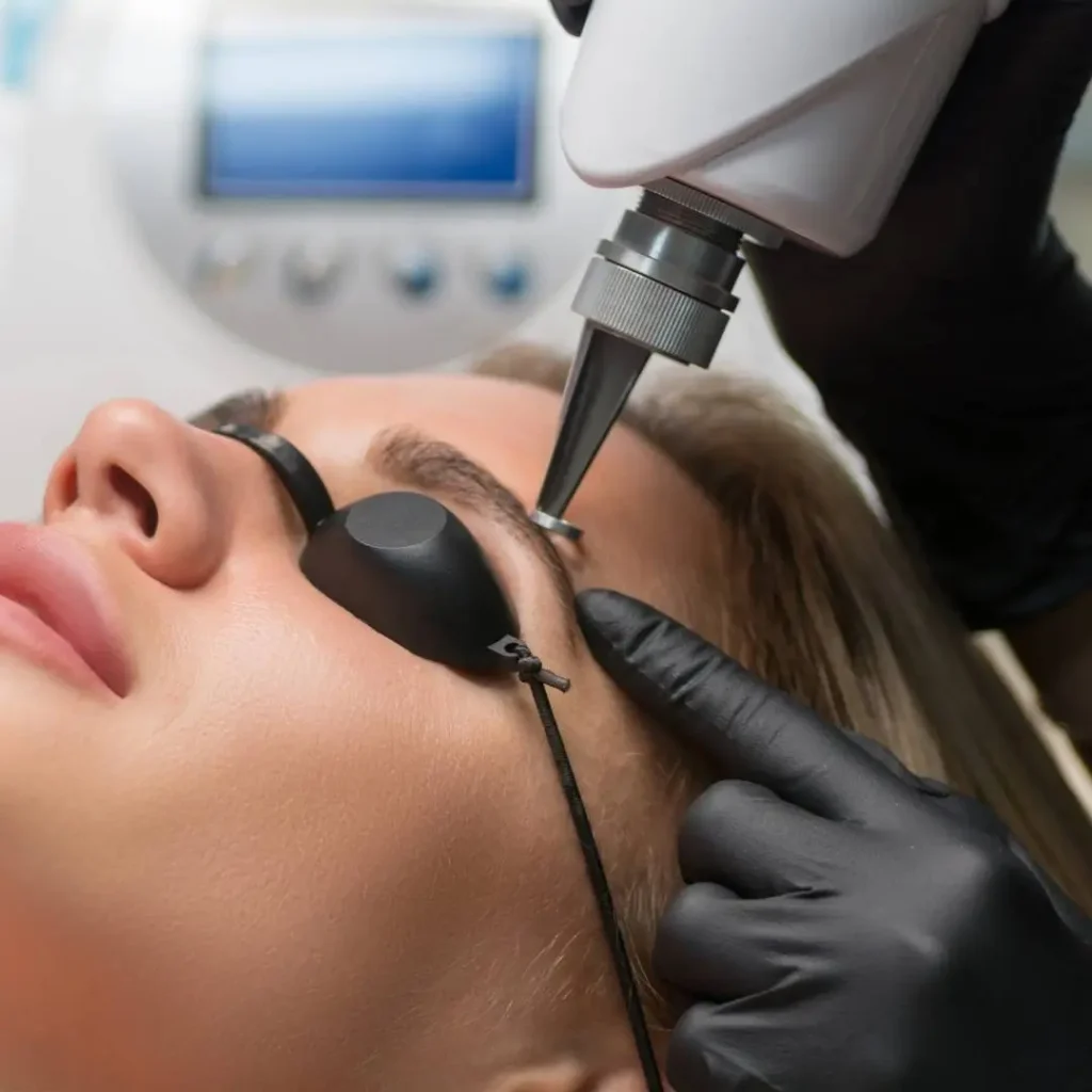 Reliable Eyebrow Tattoo Removal